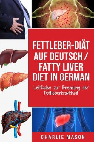 Cover of Fettleber-Diät Auf Deutsch/ Fatty liver diet In German: Leitfaden zur Beendung der Fettleberkrankheit