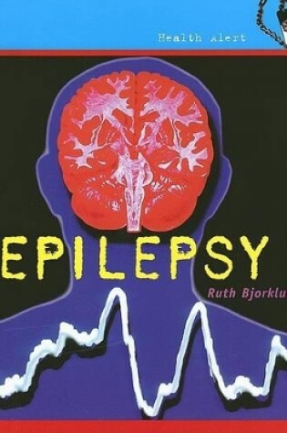 Cover of Epilepsy