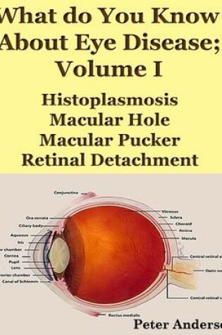 Cover of What Do You Know About Eye Disease; Volume I: Histoplasmosis, Macular Hole, Macular Pucker and Retinal Detachment