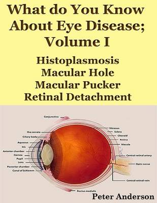 Book cover for What Do You Know About Eye Disease; Volume I: Histoplasmosis, Macular Hole, Macular Pucker and Retinal Detachment