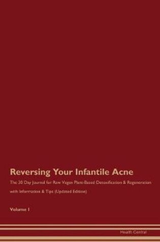 Cover of Reversing Your Infantile Acne