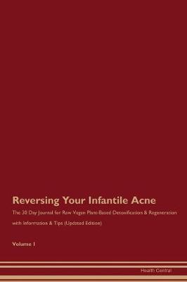 Book cover for Reversing Your Infantile Acne