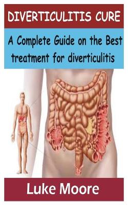 Book cover for Diverticulitis Cure
