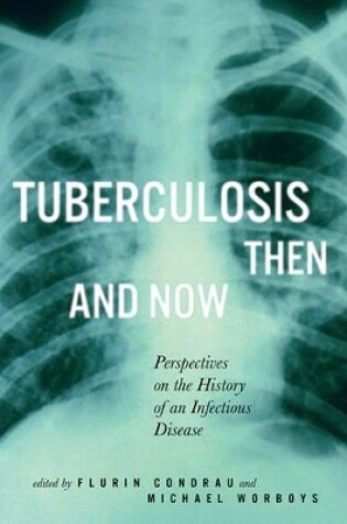 Cover of Tuberculosis Then and Now