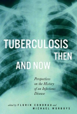 Book cover for Tuberculosis Then and Now