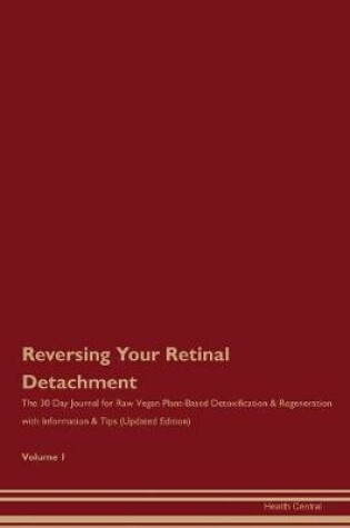 Cover of Reversing Your Retinal Detachment