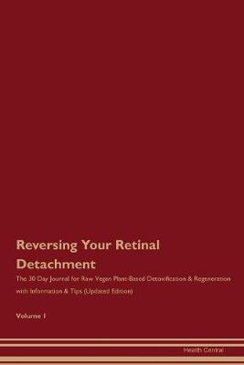 Book cover for Reversing Your Retinal Detachment