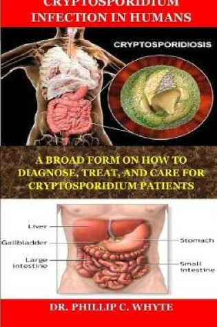 Cover of Cryptosporidium Infection in Humans