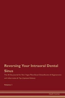 Book cover for Reversing Your Intraoral Dental Sinus