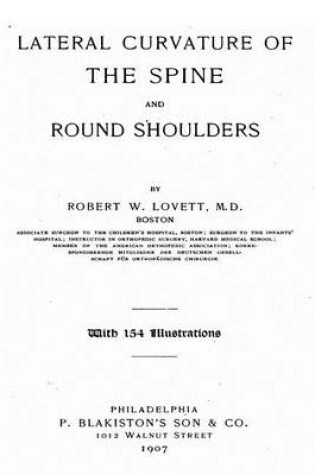 Cover of Lateral Curvature of the Spine and Round Shoulders