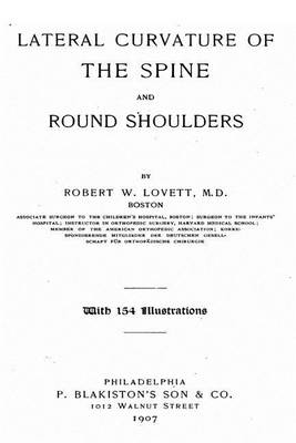 Book cover for Lateral Curvature of the Spine and Round Shoulders