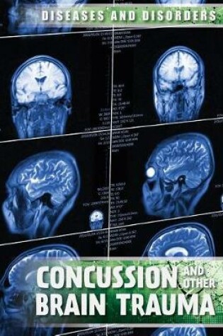 Cover of Concussions and Other Brain Trauma