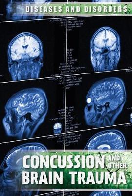 Book cover for Concussions and Other Brain Trauma