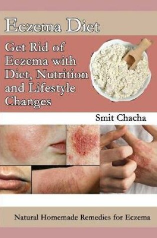 Cover of Eczema Diet - Get Rid of Eczema with Diet, Nutrition and Lifestyle Changes
