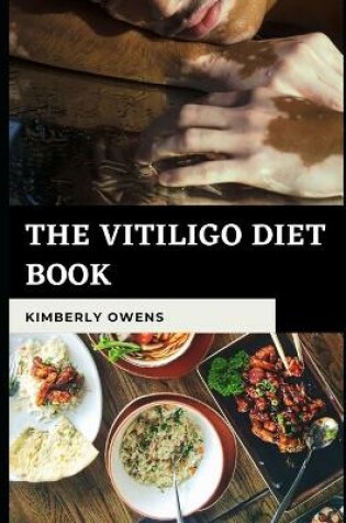 Cover of The Vitiligo Diet Book