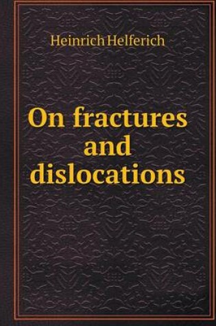 Cover of On fractures and dislocations