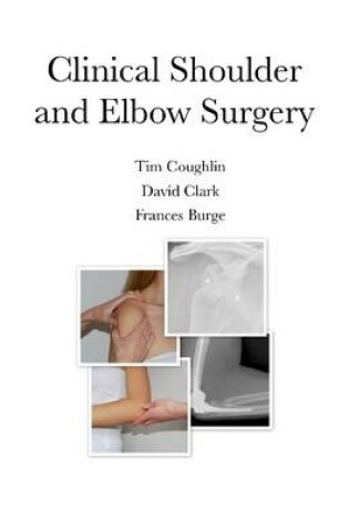 Cover of Clinical Shoulder and Elbow Surgery