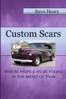 Book cover for Custom Scars