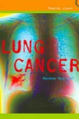 Cover of Lung Cancer