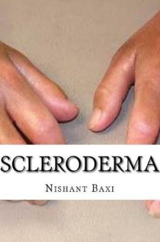 Cover of Scleroderma