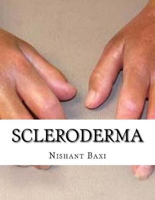 Book cover for Scleroderma