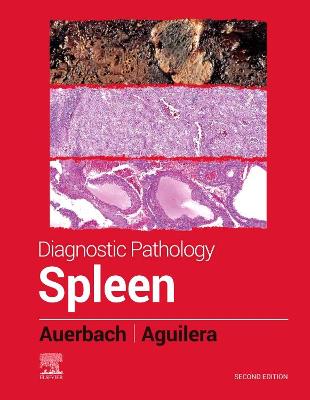 Book cover for Spleen - E-Book