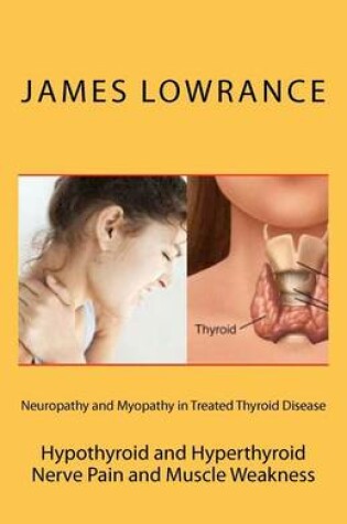 Cover of Neuropathy and Myopathy in Treated Thyroid Disease