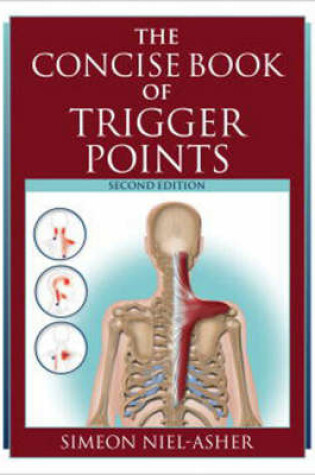 Cover of The Concise Book of Trigger Points