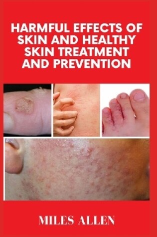 Cover of Harmful Effects of Skin and Healthy Skin Treatment and Prevention