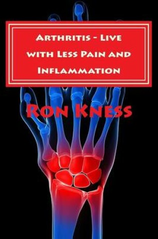 Cover of Arthritis - Live with Less Pain and Inflammation