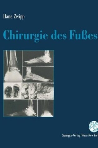 Cover of Chirurgie Des Fuaes