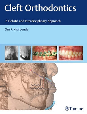 Book cover for Cleft Orthodontics