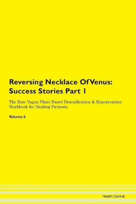 Book cover for Reversing Necklace Of Venus