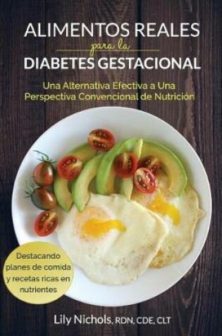 Cover of Alimentos Reales Para La Diabetes Gestacional