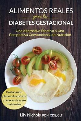 Book cover for Alimentos Reales Para La Diabetes Gestacional