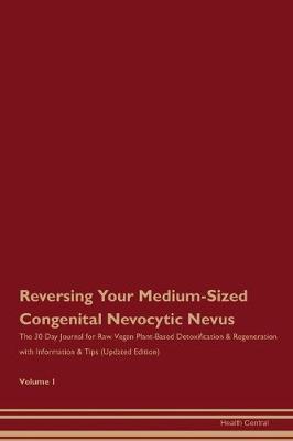 Book cover for Reversing Your Medium-Sized Congenital Nevocytic Nevus