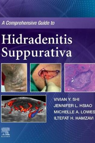 Cover of A Comprehensive Guide to Hidradenitis Suppurativa - eBook