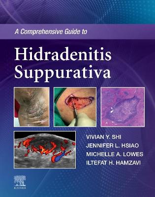 Cover of A Comprehensive Guide to Hidradenitis Suppurativa - eBook