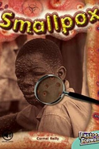 Cover of Smallpox