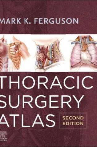 Cover of Thoracic Surgery Atlas - E-Book