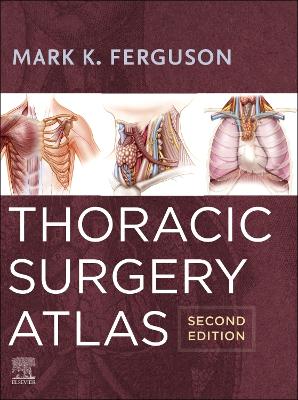 Book cover for Thoracic Surgery Atlas - E-Book