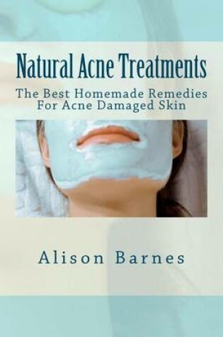 Cover of Natural Acne Treatments