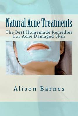 Book cover for Natural Acne Treatments