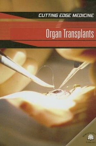 Cover of Organ Transplants