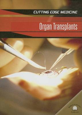 Book cover for Organ Transplants