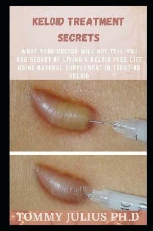 Cover of Keloid Treatment Secrets