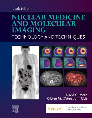 Book cover for Nuclear Medicine and Molecular Imaging - E-Book