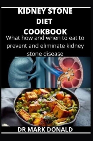 Cover of Kidney Stone Diet Cookbook