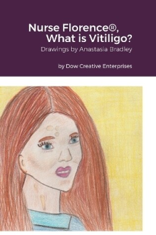 Cover of Nurse Florence(R), What is Vitiligo?