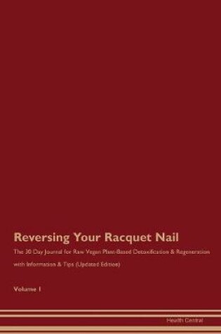 Cover of Reversing Your Racquet Nail